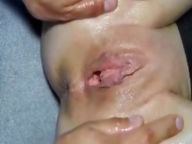 Hopeful Teen Battle-axe enormi penetrazioni fisting
